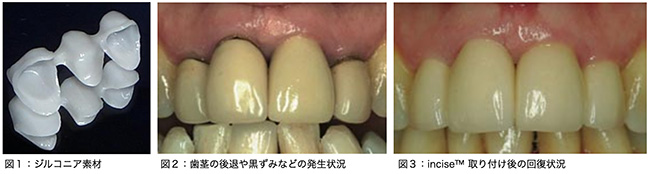 renishaw-3-in-1-image-2025-06-17-650×174 3 sets of teeth being examined