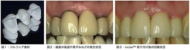 3 sets of teeth being examined