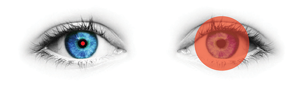 Comparison of exit pupil size between binocular and eyepiece-less viewing